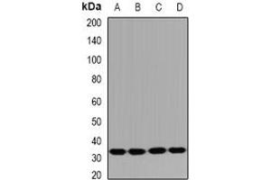 Image no. 1 for anti-HUS1 Checkpoint Homolog B (HUS1B) (full length) antibody (ABIN6043554)