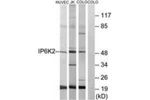 Image no. 1 for anti-Inositol Hexakisphosphate Kinase 2 (IP6K2) (AA 161-210) antibody (ABIN1534177)