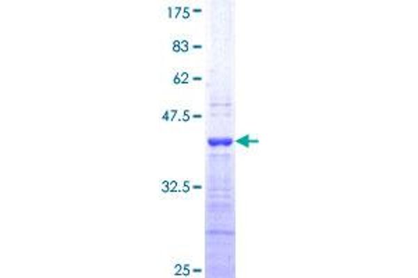 Endothelin 1 (EDN1) (AA 113-212) protein (GST tag)