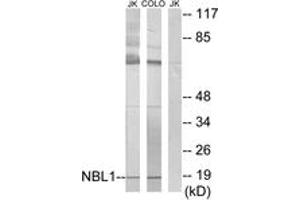 Image no. 1 for anti-Neuroblastoma 1, DAN Family BMP Antagonist (NBL1) (AA 131-180) antibody (ABIN1533727)