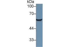 Image no. 2 for anti-Serine (Or Cysteine) Peptidase Inhibitor, Clade C (Antithrombin), Member 1 (SERPINC1) (AA 33-465) antibody (ABIN1077810)