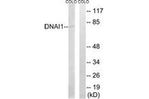 Western blot analysis of extracts from COLO cells, using DNAI1 Antibody.