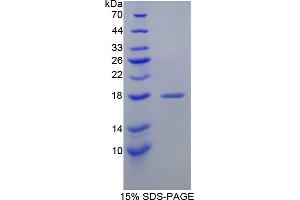 Image no. 1 for Fatty Acid Binding Protein 6, Ileal (FABP6) (AA 1-128) protein (T7 tag,His tag) (ABIN6236638)