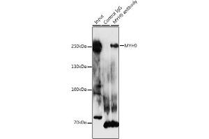 Immunoprecipitation analysis of 300 μg extracts of HeLa cells using 3 μg MYH9 antibody (ABIN1513234, ABIN3020656, ABIN3020657 and ABIN6213646).