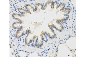 Immunohistochemistry of paraffin-embedded Rat lung using TICAM1 Polyclonal Antibody at dilution of 1:100 (40x lens).
