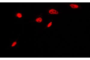 Image no. 3 for anti-Aryl Hydrocarbon Receptor (AHR) (N-Term) antibody (ABIN6925843)