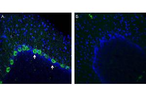 Expression of NMUR1 in rat cerebellum.