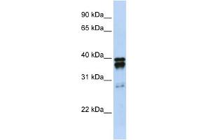 Image no. 1 for anti-Nudix (Nucleoside Diphosphate Linked Moiety X)-Type Motif 18 (NUDT18) (N-Term) antibody (ABIN2783562)