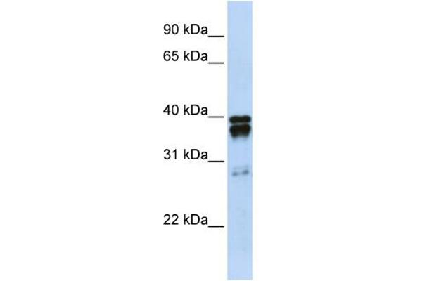 anti-Nudix (Nucleoside Diphosphate Linked Moiety X)-Type Motif 18 (NUDT18) (N-Term) antibody