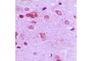 Immunohistochemical analysis of c-FER staining in human brain formalin fixed paraffin embedded tissue section.