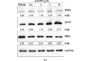 Image no. 6 for anti-Periaxin (PRX) (Center) antibody (ABIN2855135)