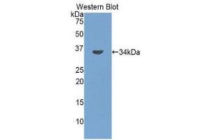 Image no. 1 for anti-Bone Marrow Stromal Cell Antigen 1 (BST1) (AA 41-300) antibody (ABIN1858175)