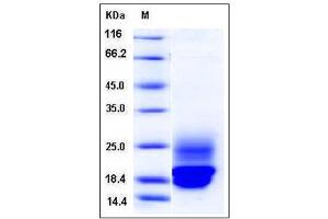 Image no. 1 for Cystatin C (CST3) (AA 1-140) protein (His tag) (ABIN2009079)