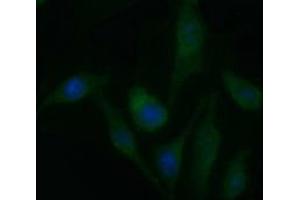 Image no. 2 for anti-Platelet Derived Growth Factor Receptor beta (PDGFRB) antibody (ABIN1500102)
