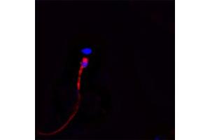 Image no. 8 for anti-Cathelicidin Antimicrobial Peptide (CAMP) antibody (ABIN571374)
