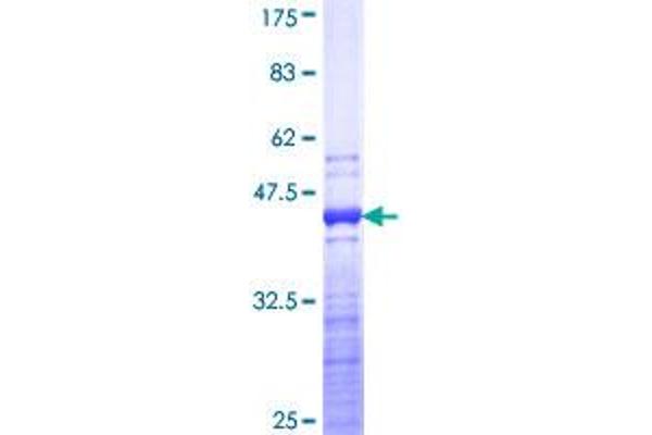 TNNT3 Protein (AA 161-258) (GST tag)
