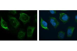 ICC/IF Image C3 antibody [C3], C-term detects C3 protein at cytoplasm by immunofluorescent analysis.