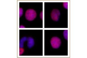 Image no. 3 for anti-H2A Histone Family, Member Z (H2AFZ) (C-Term) antibody (ABIN6971773)