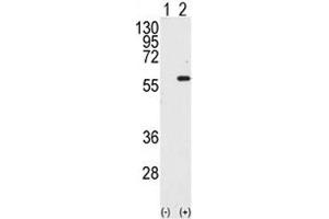 Image no. 2 for anti-serine/threonine Kinase 4 (STK4) (AA 385-415) antibody (ABIN3032542)