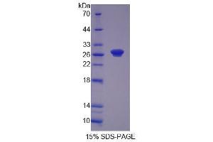 Image no. 1 for Ribonucleotide Reductase M1 (RRM1) (AA 1-213) protein (His tag) (ABIN6239969)