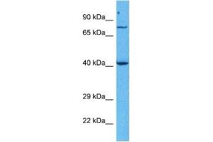 Image no. 6 for anti-Forkhead Box M1 (FOXM1) (Middle Region) antibody (ABIN2792172)