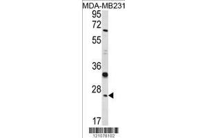 Image no. 1 for anti-Glutathione S-Transferase mu 1 (GSTM1) (AA 184-211), (C-Term) antibody (ABIN390883)