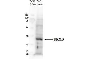 Image no. 3 for anti-Uroporphyrinogen Decarboxylase (UROD) (N-Term) antibody (ABIN2773790)