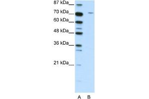 Image no. 1 for anti-Leucine Zipper, Putative Tumor Suppressor 1 (LZTS1) (C-Term) antibody (ABIN2781137)
