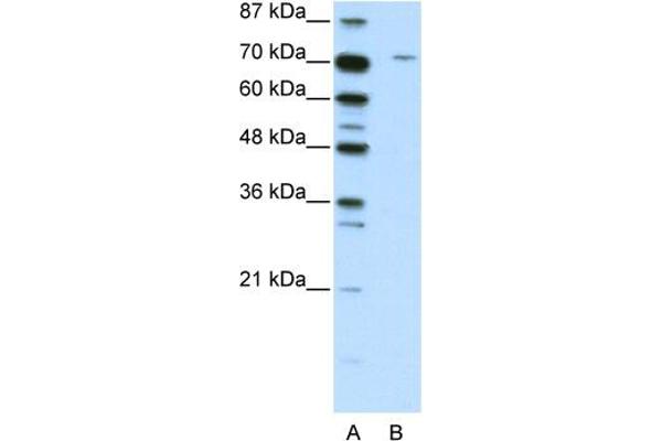 anti-Leucine Zipper, Putative Tumor Suppressor 1 (LZTS1) (C-Term) antibody