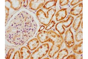 IHC image of ABIN7144860 diluted at 1:600 and staining in paraffin-embedded human kidney tissue performed on a Leica BondTM system.