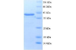 Image no. 1 for Protein tyrosine Phosphatase, Receptor Type, B (PTPRB) (AA 1643-1997) protein (His tag) (ABIN5713768)