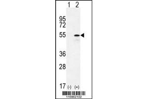 Western Blotting (WB) image for anti-Cytochrome P450, Family 26, Subfamily B, Polypeptide 1 (CYP26B1) antibody (ABIN2158440)