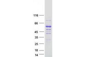 Image no. 1 for Syntrophin, beta 2 (Dystrophin-Associated Protein A1, 59kDa, Basic Component 2) (SNTB2) protein (Myc-DYKDDDDK Tag) (ABIN2733133)