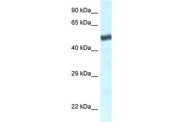 anti-Transducin (Beta)-Like 1 X-Linked Receptor 1 (TBL1XR1) (C-Term) antibody