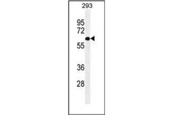 PATL2 antibody  (Middle Region)