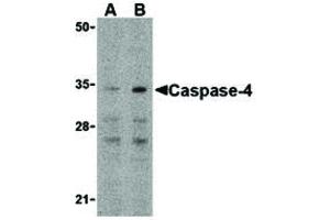 Image no. 1 for anti-Caspase 4, Apoptosis-Related Cysteine Peptidase (CASP4) (N-Term) antibody (ABIN6655931)