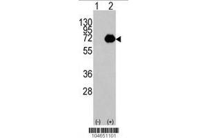 Image no. 1 for anti-Acyl-CoA Oxidase 1, Palmitoyl (ACOX1) (AA 629-659), (C-Term) antibody (ABIN389100)