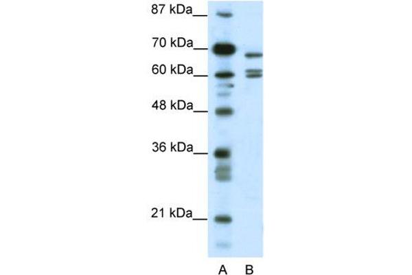 anti-Potassium Channel, Subfamily K, Member 5 (KCNK5) (C-Term) antibody