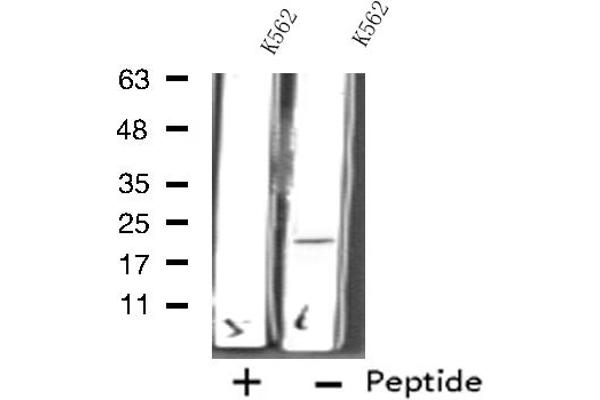 RPL11 antibody  (C-Term)