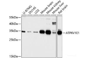 ATP6V1E1 anticorps
