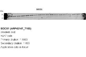 Image no. 3 for anti-Suppressor of Cytokine Signaling 1 (SOCS1) (N-Term) antibody (ABIN2777164)