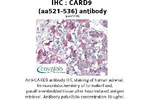 Image no. 1 for anti-Caspase Recruitment Domain Family, Member 9 (CARD9) (AA 521-536) antibody (ABIN1732641)