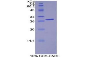 Image no. 1 for Pyruvate Dehydrogenase Kinase 1 (PDK1) protein (ABIN3011407)