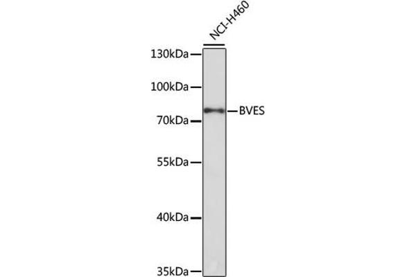 BVES antibody  (AA 241-360)