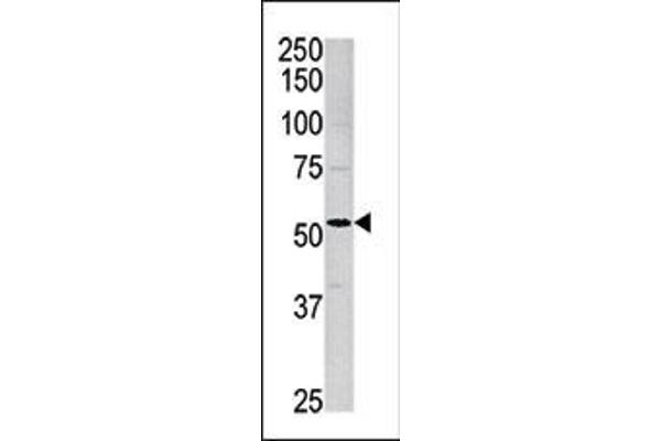 ACVR1 antibody  (AA 85-123)