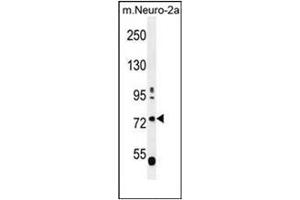 Image no. 2 for anti-Leucine-Rich Repeat and WD Repeat-Containing Protein 1 (LRWD1) (AA 4-33), (N-Term) antibody (ABIN953241)