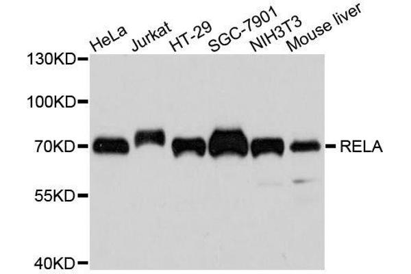 anti-Nuclear Factor-kB p65 (NFkBP65) antibody