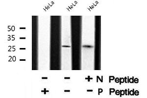 Image no. 7 for anti-Cyclin-Dependent Kinase Inhibitor 1B (p27, Kip1) (CDKN1B) (pThr157) antibody (ABIN6271268)