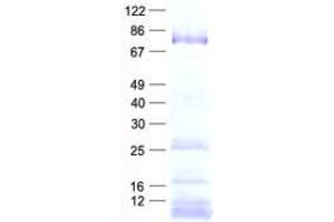 Image no. 1 for DEAD (Asp-Glu-Ala-Asp) Box Polypeptide 18 (DDX18) protein (His tag) (ABIN2719275)