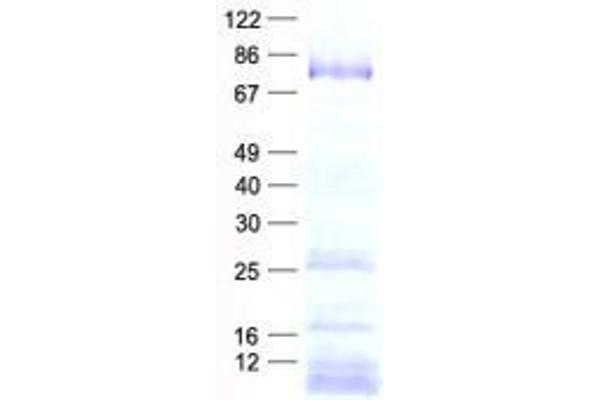 DEAD (Asp-Glu-Ala-Asp) Box Polypeptide 18 (DDX18) protein (His tag)